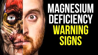 10 Signs of Magnesium Deficiency to Never Ignore [upl. by Nazus]