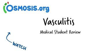 Vasculitis  Clinical Presentation [upl. by Winnie624]