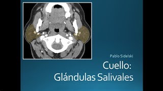 Cuello Glándulas Salivales [upl. by Amund]