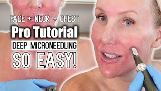 Deep Microneedling on Face  Neck  Chest 💕 PRO TUTORIAL microneedling antiagingskincare [upl. by Eillib153]