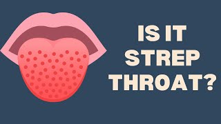 Strep Throat  10 Symptoms You Cant Ignore sick symptoms signs strepthroat [upl. by Gadmann884]