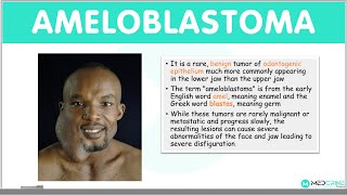 Ameloblastoma Types Clinical Features Diagnosis Differentials and Management [upl. by Neirb]