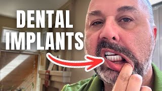 How Dental Implants Made Me Lose 40Lbs [upl. by Rabjohn7]