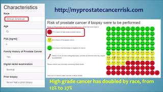 Screening for Prostate Cancer [upl. by Nareht763]