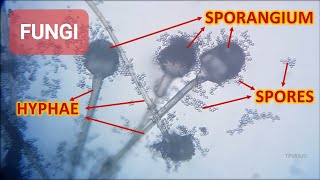 PREPARATION OF FUNGI SLIDE [upl. by Uahsoj]