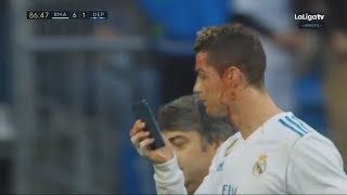 Cristiano Ronaldo Lesión en la cara  Real Madrid vs Deportivo La Coruna 71  La Liga 21012018 [upl. by Eelibuj385]