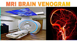 HOW TO DO MRI BRAIN VENOGRAM [upl. by Nnayrrehs715]