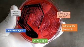 XLD agar having growth of Salmonella Typhi and paratyphi [upl. by Annoyik]