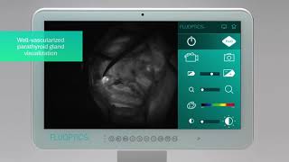 FLUOBEAM® IN ACTION  Endocrine surgery  Checking the parathyroid gland vascularization [upl. by Leopoldeen]