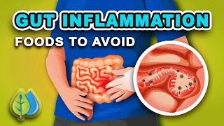 Top 5 Foods that Cause GUT Inflammation  AVOID  eat these anti inflammatory foods [upl. by Camilia855]