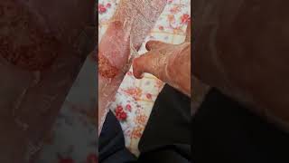 How to peel off dead skin  ASMR [upl. by Antrim]