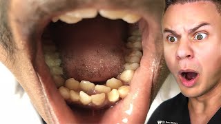 Orthodontist Reacts To The WEIRDEST Teeth On TikTok [upl. by Rosamond]