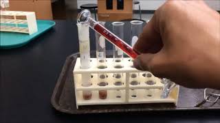 Liver and Catalase makeup lab video [upl. by Lela]