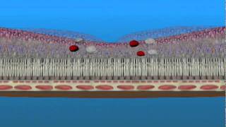 Edema Macular y Isquemia Macular [upl. by Sitruc267]