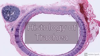 Histology of Trachea [upl. by Tiler]