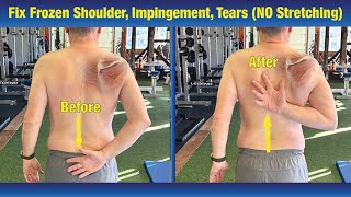 INCREDIBLE way to Fix Frozen Shoulder amp Impingement  NO Stretching or PT Exercises [upl. by Borreri]