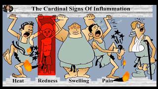 Cardinal signs of inflammation Prostaglandins and Leukotrienes [upl. by Haisoj]