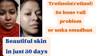 How to use Tretinoin in proper way  Tretinoinretinol se hone vali problem or unka smadhan [upl. by Ronnica589]