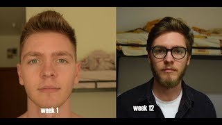 Patchy blonde beard Time Lapse  3 Months [upl. by Nabetse432]