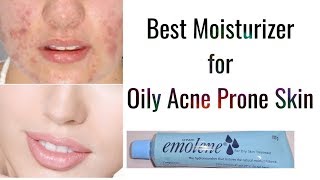 Top Moisturizer for Oily and Acne Prone skin  Emolene Cream  Angel Secrets [upl. by Anilad411]