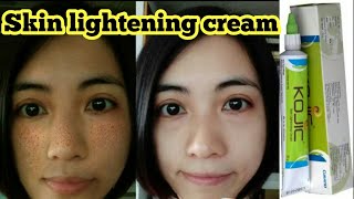 Kojic Skin lightening cream  Melasma  Dark spot  Pigmentation Removal cream  Brijwasi Girl [upl. by Cortney852]