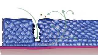 Natural History of HPV Infection [upl. by Aikkan]