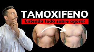 Tudo sobre Tamoxifeno e Ginecomastia [upl. by Lohse258]