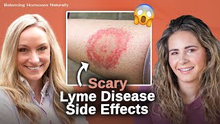 Everything to Know About Lyme Disease Prevention Diagnosis amp Treatment  Dr Casey Kelley [upl. by Ecnahoy]