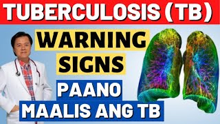 Tuberculosis TB Warnings Signs Paano Maalis ang TB  By Doc Willie Ong [upl. by Lewin]