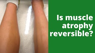 Is muscle atrophy reversible [upl. by Maximilien]