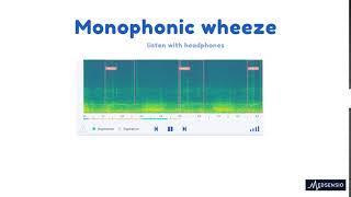 Lung sounds  monophonic wheeze [upl. by Anilem]