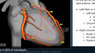 This Video Can Save Your Life Pt2 Catheter Angiogram Stentmov [upl. by Hassin]