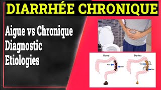 Diarrhée Chronique Définition Causes Formes Cliniques  Gastrologie Medicale [upl. by Nonahs]