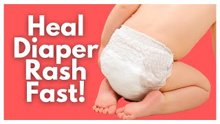 Ultimate Diaper Rash Guide  Tips For Tough Diaper Rashes [upl. by Nasar922]