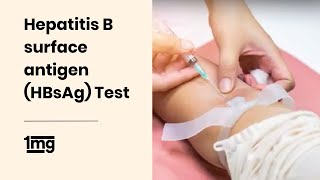 Hepatitis B surface antigen HBsAg Test  1mg [upl. by Einahpit8]