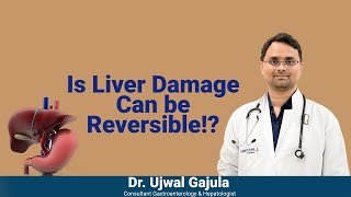 Chronic Liver Disease be cured  Liver Damages can be Reversible  Dr Ujwal Gastroenterologist [upl. by Di]