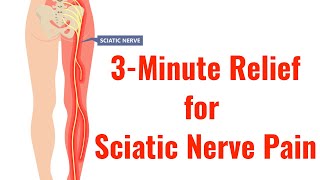 3 of the Best Exercises for Relief of Sciatic Nerve Pain With FREE Exercise Sheet [upl. by Wailoo871]