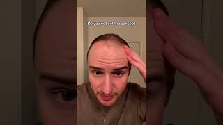 Do you not get the concept hair hairtransformation hairgrowth [upl. by Nairbal]