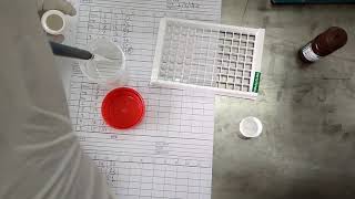 HBsAg ELISA test procedure [upl. by Forkey]