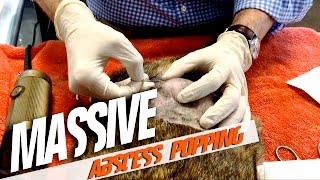 Massive Abscess Popping [upl. by O'Callaghan]