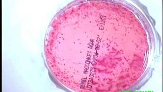 E coli TimeLapse Video [upl. by Retxab]