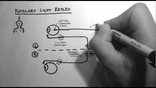 Reflexes 2  Pupillary Light Reflex [upl. by Orman52]