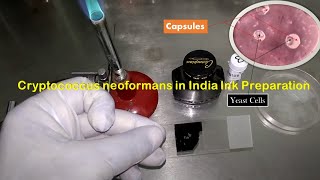 India Ink Preparation Procedure and observation of Crpytococcus neoformans capsules in CSF [upl. by Kind702]