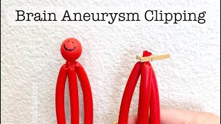 Playdough Surgery 🔪🧠🍒  Brain Aneurysm Clipping [upl. by Helbonnas741]