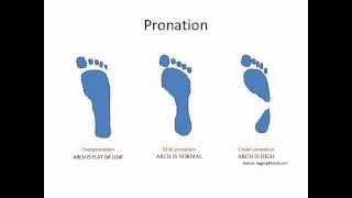 What Is Overpronation [upl. by Nilyarg]