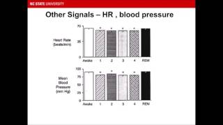 Introduction to EEG Based Polysomnography  Sleep Study [upl. by Gnaig769]