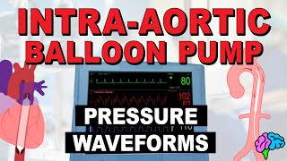 IABP Waveforms amp Pressures EXPLAINED [upl. by Arnon417]