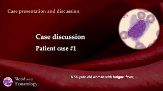 Patient case discussion case 1 [upl. by Ariak797]