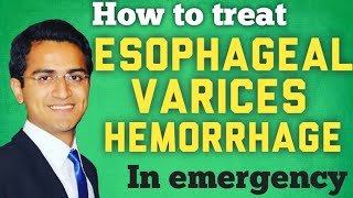 Esophageal Varices amp Variceal Hemorrhage Treatment and ManagmentSTEP WISE APPROACH [upl. by Yrakaz475]