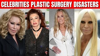 Top 10 Celebrities Plastic Surgery Disasters [upl. by Platas203]